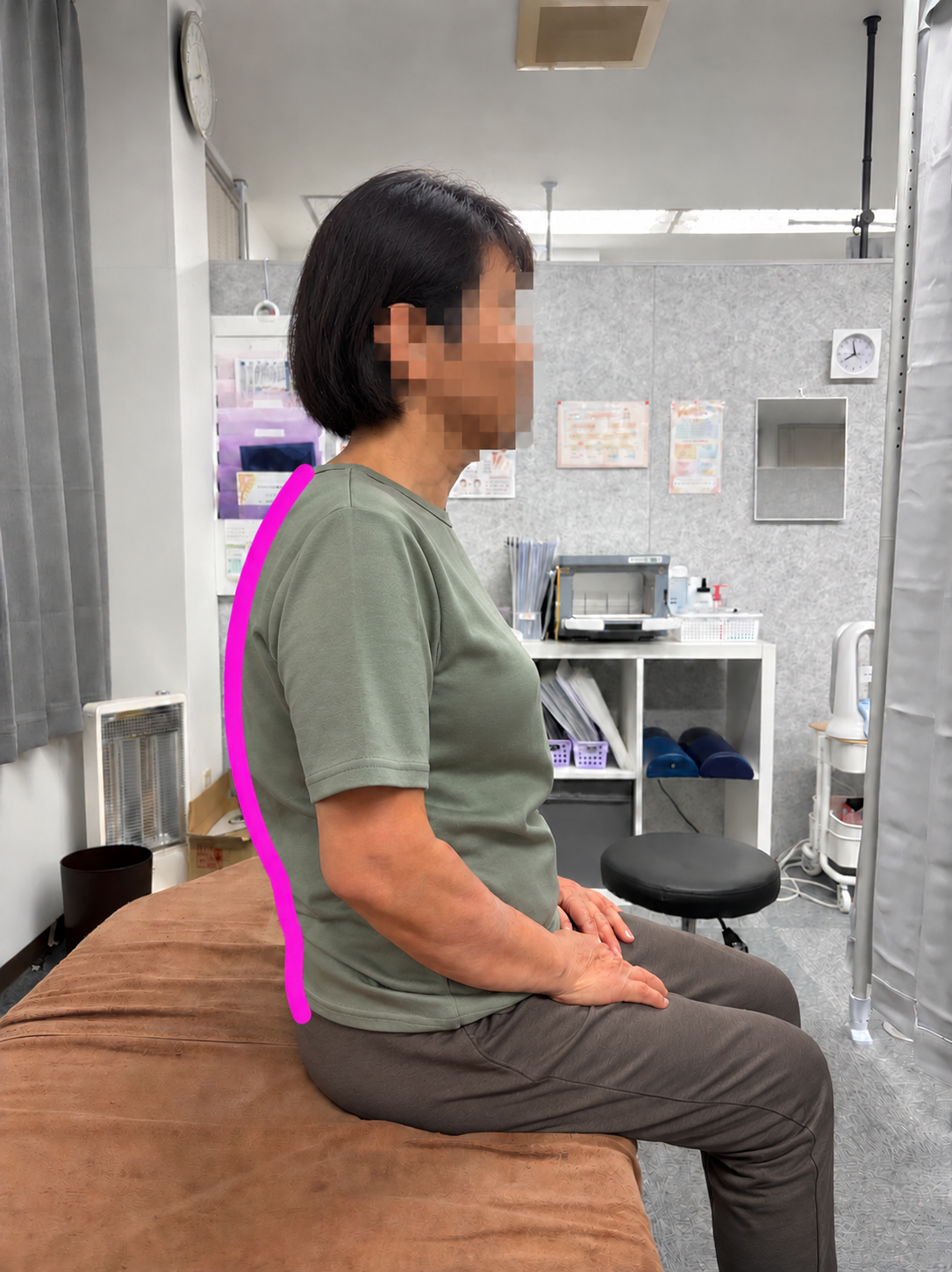 姿勢比較:施術後