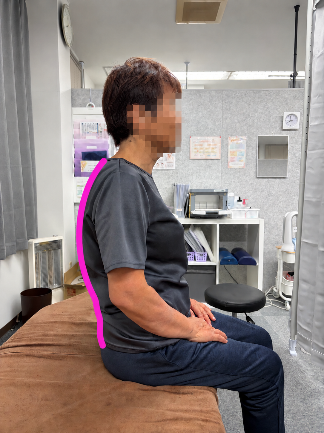 姿勢比較:施術後